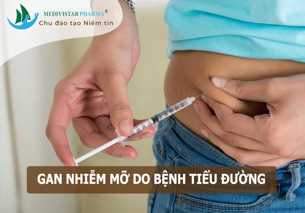 nguyên nhân gan nhiễm mỡ và cách điều trị